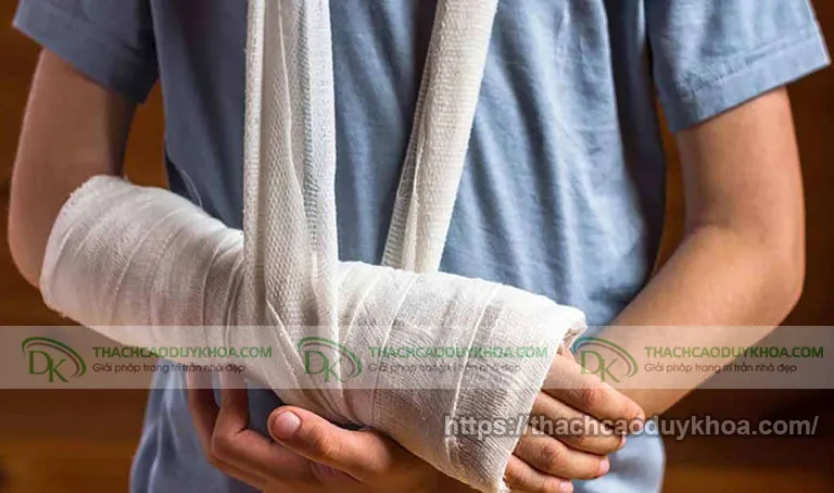 Bột thạch cao y tế được sử dụng để cố định xương